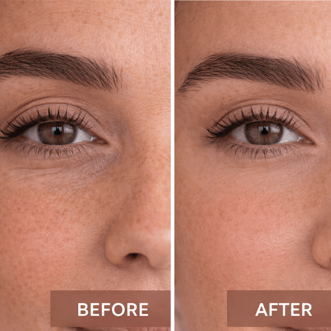 resultat before et after pour montré l'efficasité de produit