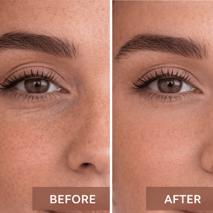 resultat before et after pour montré l'efficasité de produit