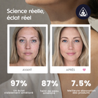 resultat de lifting pour montré l'efficasité de produit